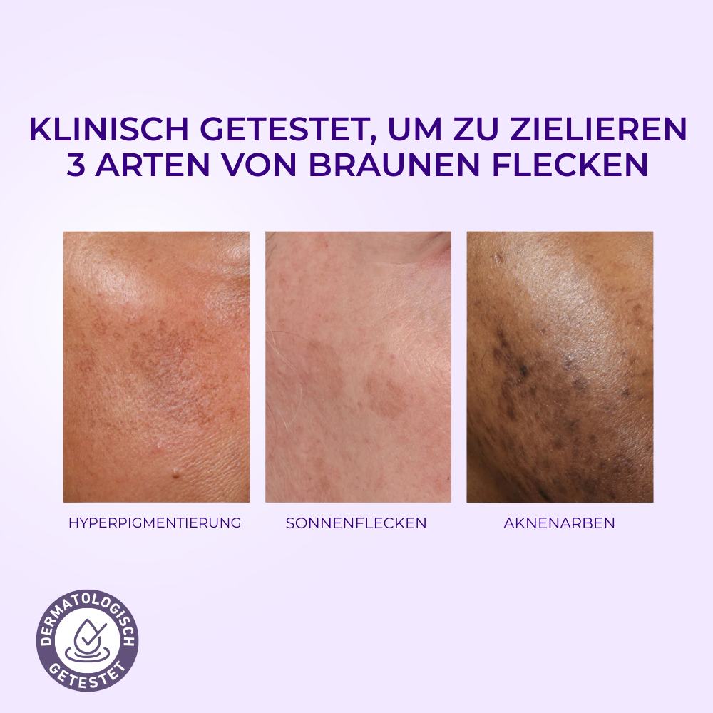 OREN Korrektur-Serum für dunkle Flecken