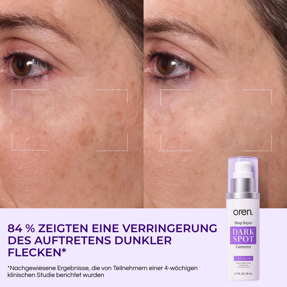 OREN Korrektur-Serum für dunkle Flecken